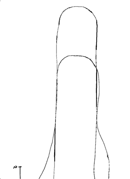 Datei:HWS-Kragen-Blatt3.png
